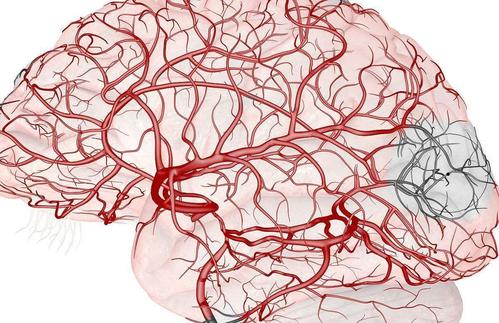 有哪些疾病容易与脑血栓疾病混淆